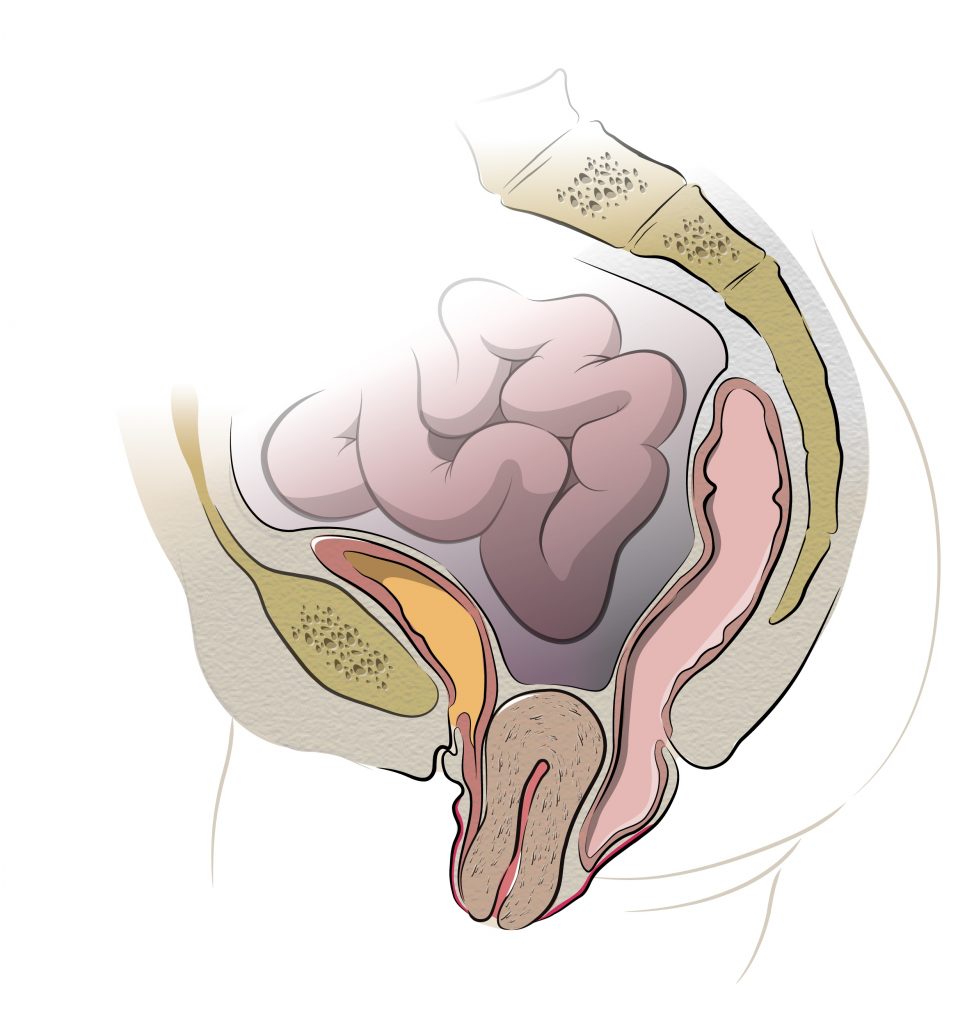 Uterine Prolapse Treatment